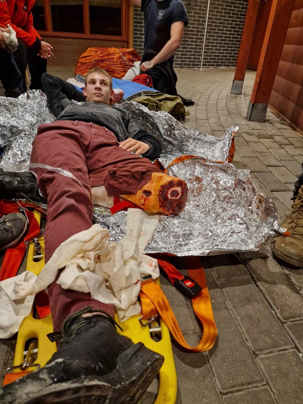 Pozorant z symulowaną urazową amputacją nogi powyżej kolana